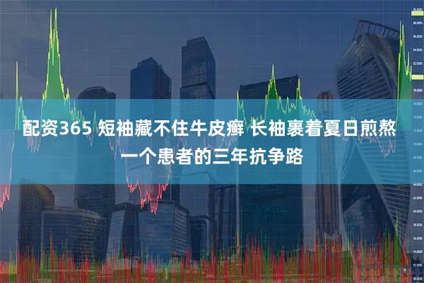 配资365 短袖藏不住牛皮癣 长袖裹着夏日煎熬 一个患者的三年抗争路